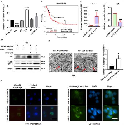 Downregulation of HMGA1 Mediates Autophagy and Inhibits Migration and Invasion in Bladder Cancer via miRNA-221/TP53INP1/p-ERK Axis